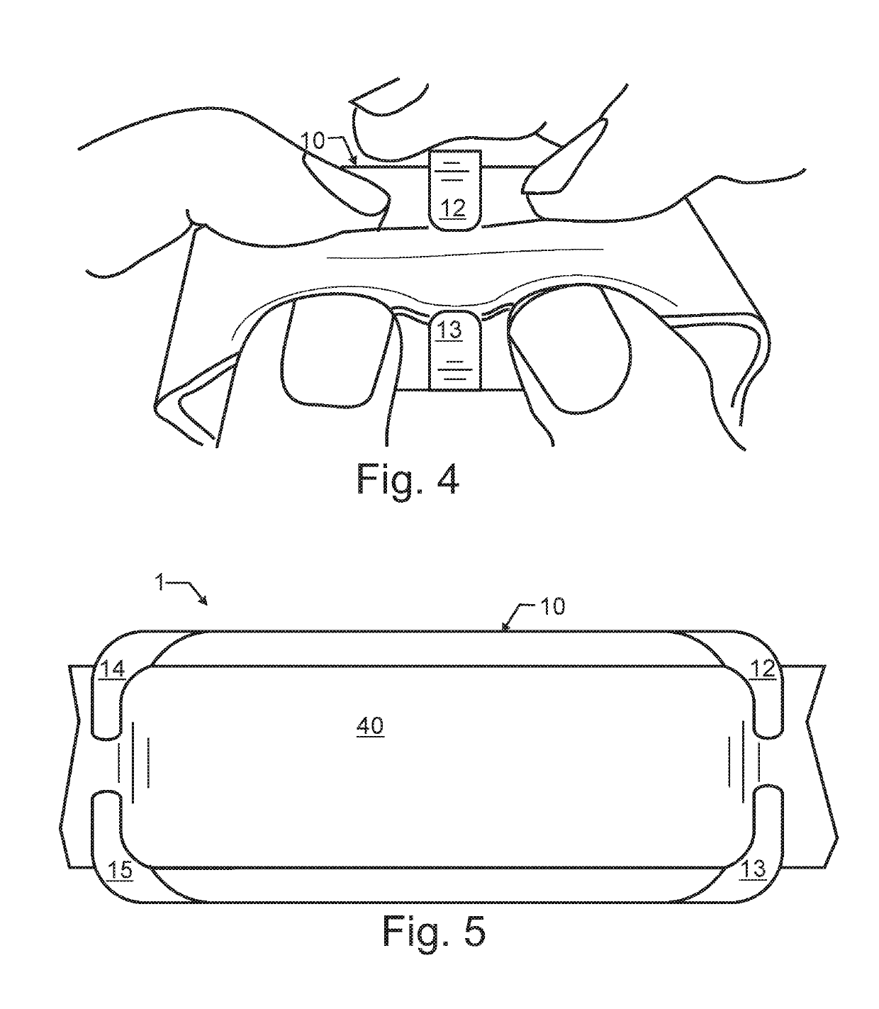 Wireless Location Assisted Zone Guidance System Incorporating a Rapid Collar Mount and Non-Necrotic Stimulation