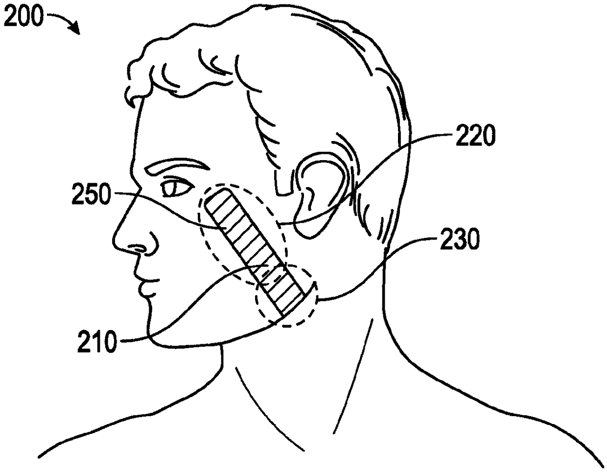 Method and apparatus for mandibular support
