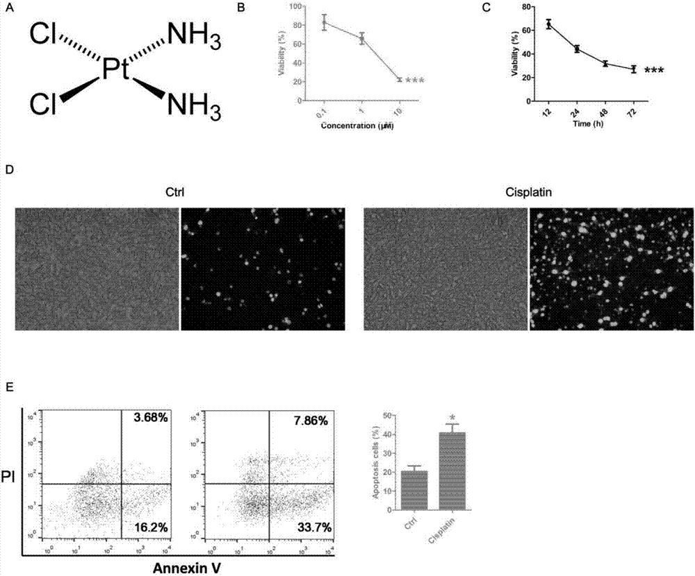Use of cis-platinum in treatment on high-level granulocyte-like myeloid derived suppressor cell (G-MDSC) bladder cancer