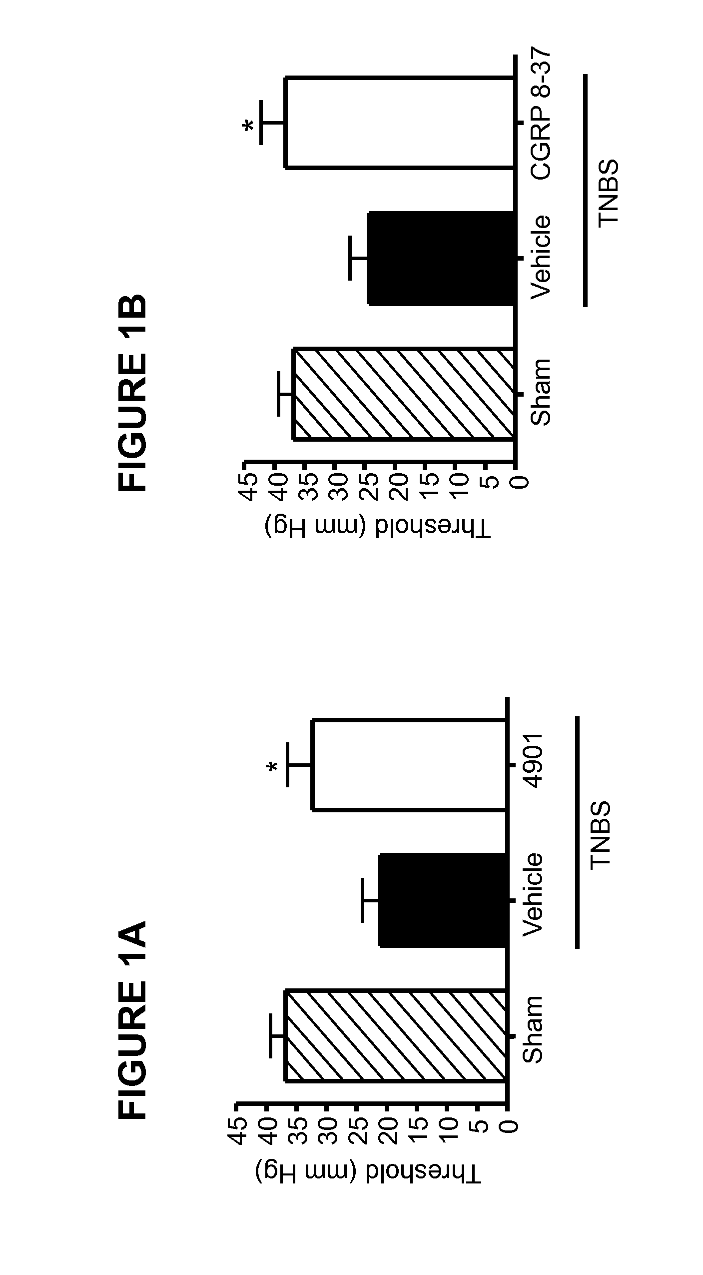 Methods for treating visceral pain by administering antagonist antibodies directed against calcitonin gene-related peptide