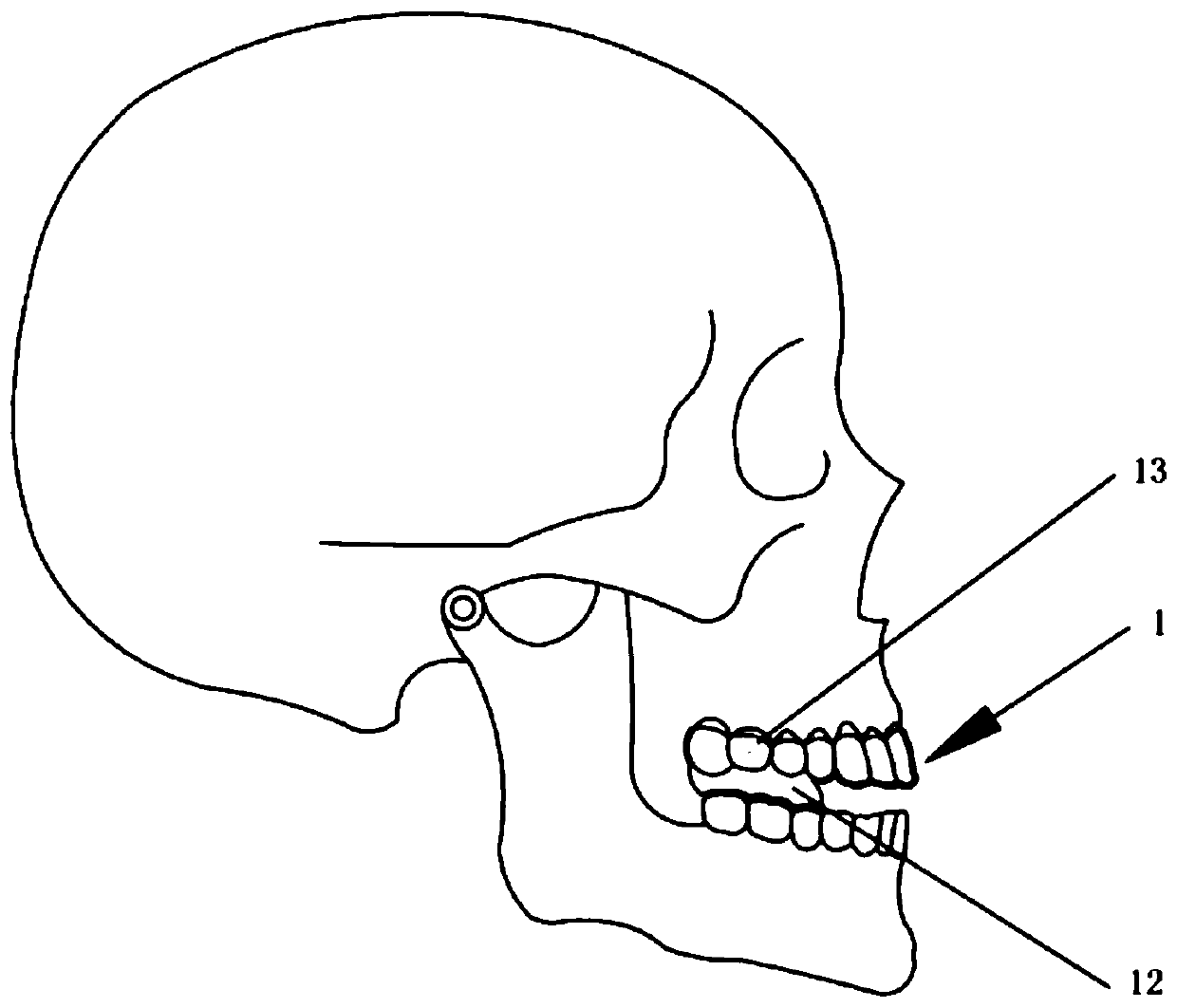 Dental-facial deformity orthopedics system and design method thereof