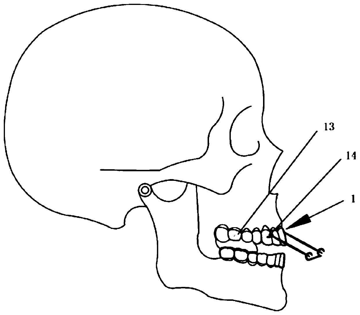Dental-facial deformity orthopedics system and design method thereof