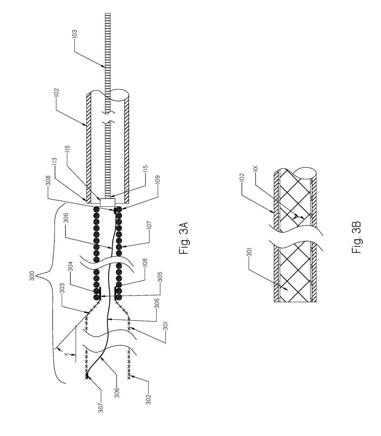 Devices and Methods for Treatment of Endovascular and Non-Endovascular Defects in Humans