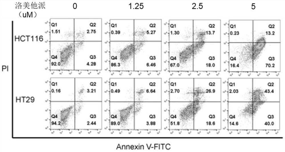 Application of lomitapide in preparation of antitumor drugs