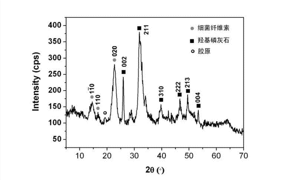 Bacterial cellulose/collagen/hydroxyapatite composite material, and preparation and application thereof