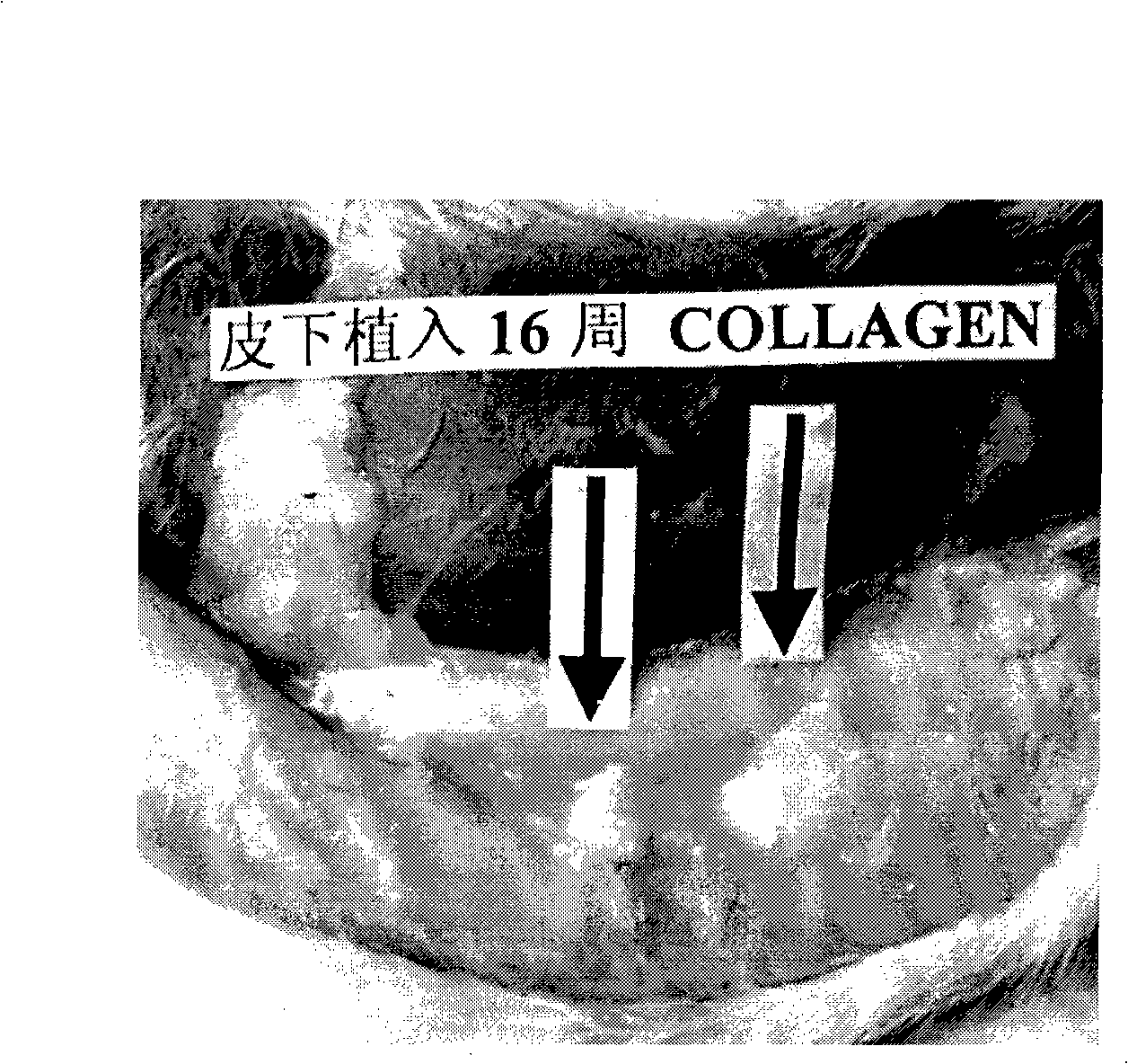 Medical grade reconstructed collagen cross-linking modified method