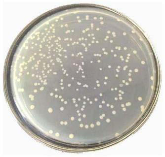 A kind of Aeromonas bacterial strain r1 and its preparation method and its application in algalytic degradation of microcystins
