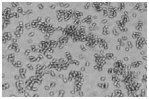 A kind of Aeromonas bacterial strain r1 and its preparation method and its application in algalytic degradation of microcystins