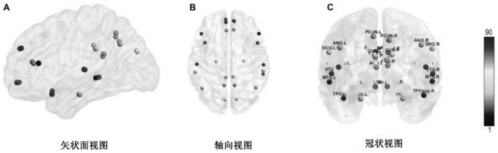 Persistent homology method for detecting influence of APOE e4 genotype on default mode network