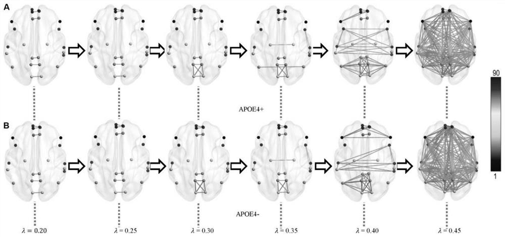 Persistent homology method for detecting influence of APOE e4 genotype on default mode network