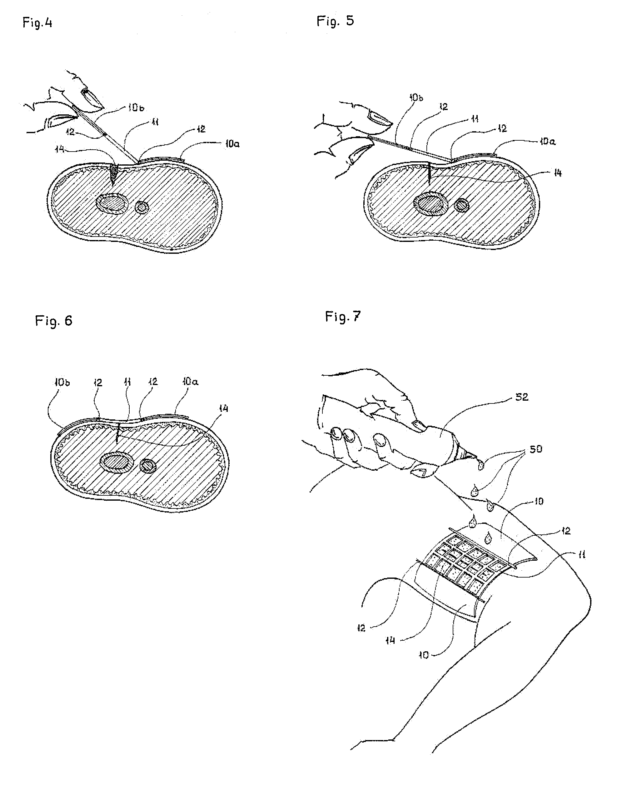 Surgical bandage and methods for treating open wounds