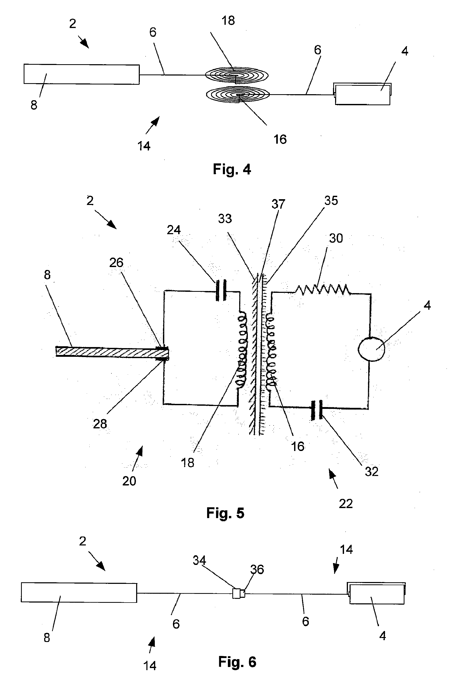 Tethered Airway Implants and Methods of Using the Same