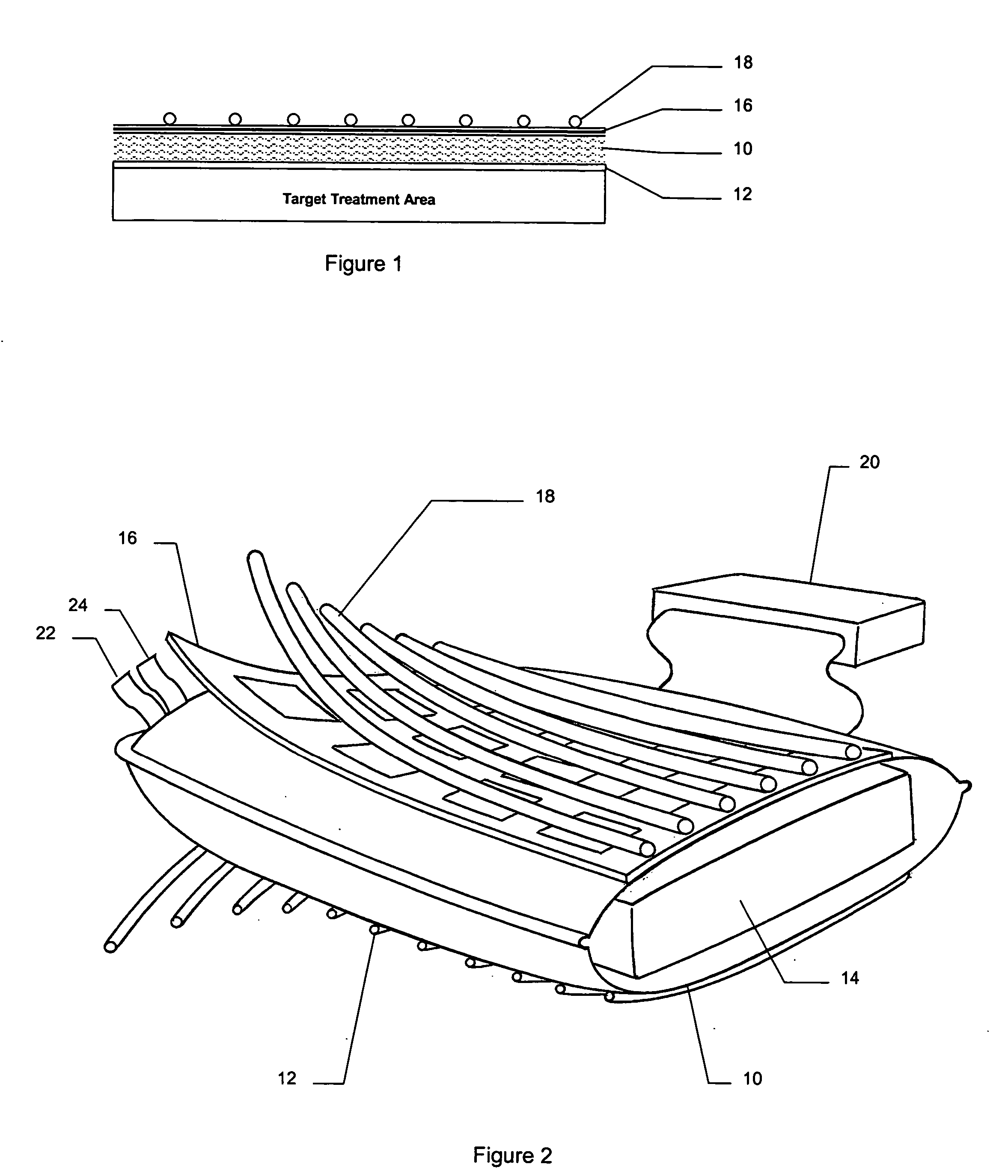 Apparatus for hyperthermia and brachytherapy delivery