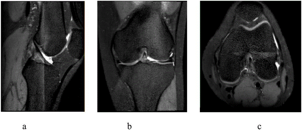 Virtual unicompartmental knee arthroplasty model construction method based on point-to-point registration technology