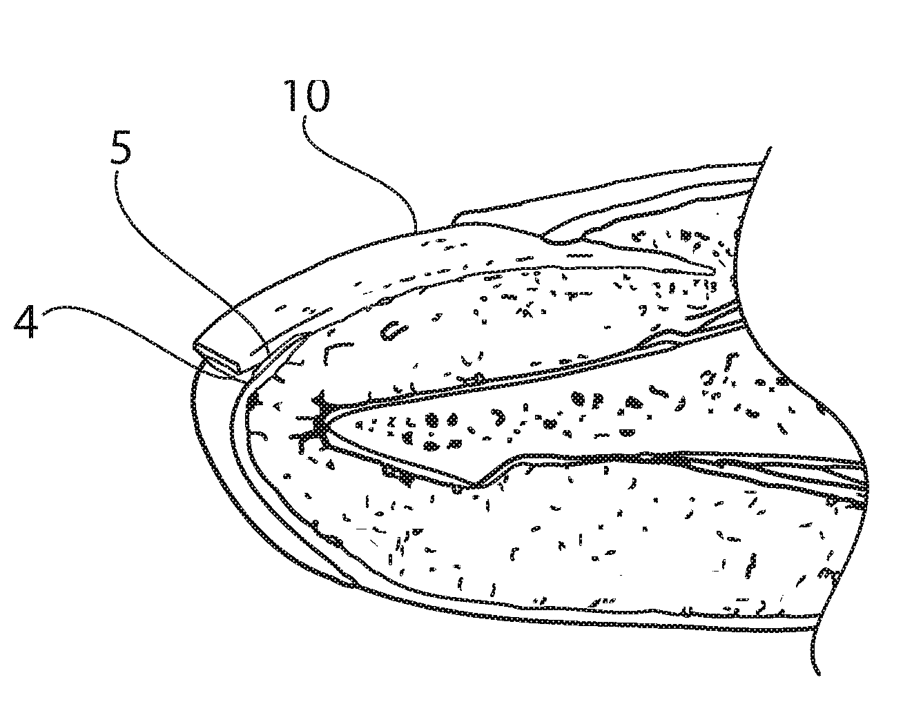 Method and Device for the Cleaning and Medical Treatment of Extremities