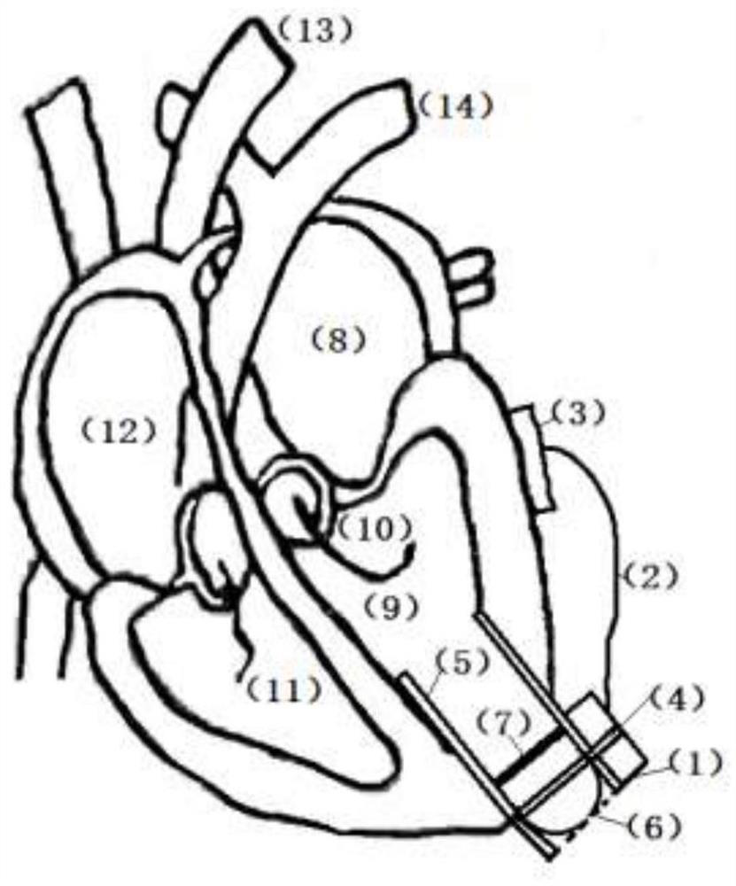 Functional artificial system for left ventricle