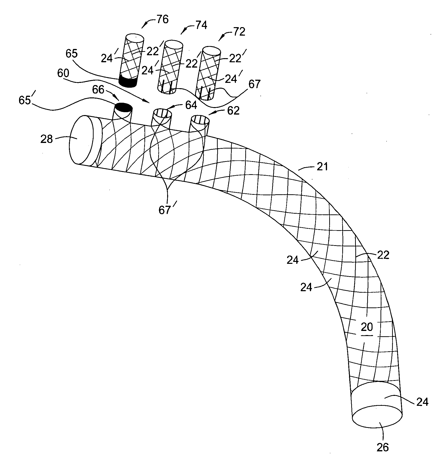 Methods and apparatus for treatment of aneurysms adjacent branch arteries