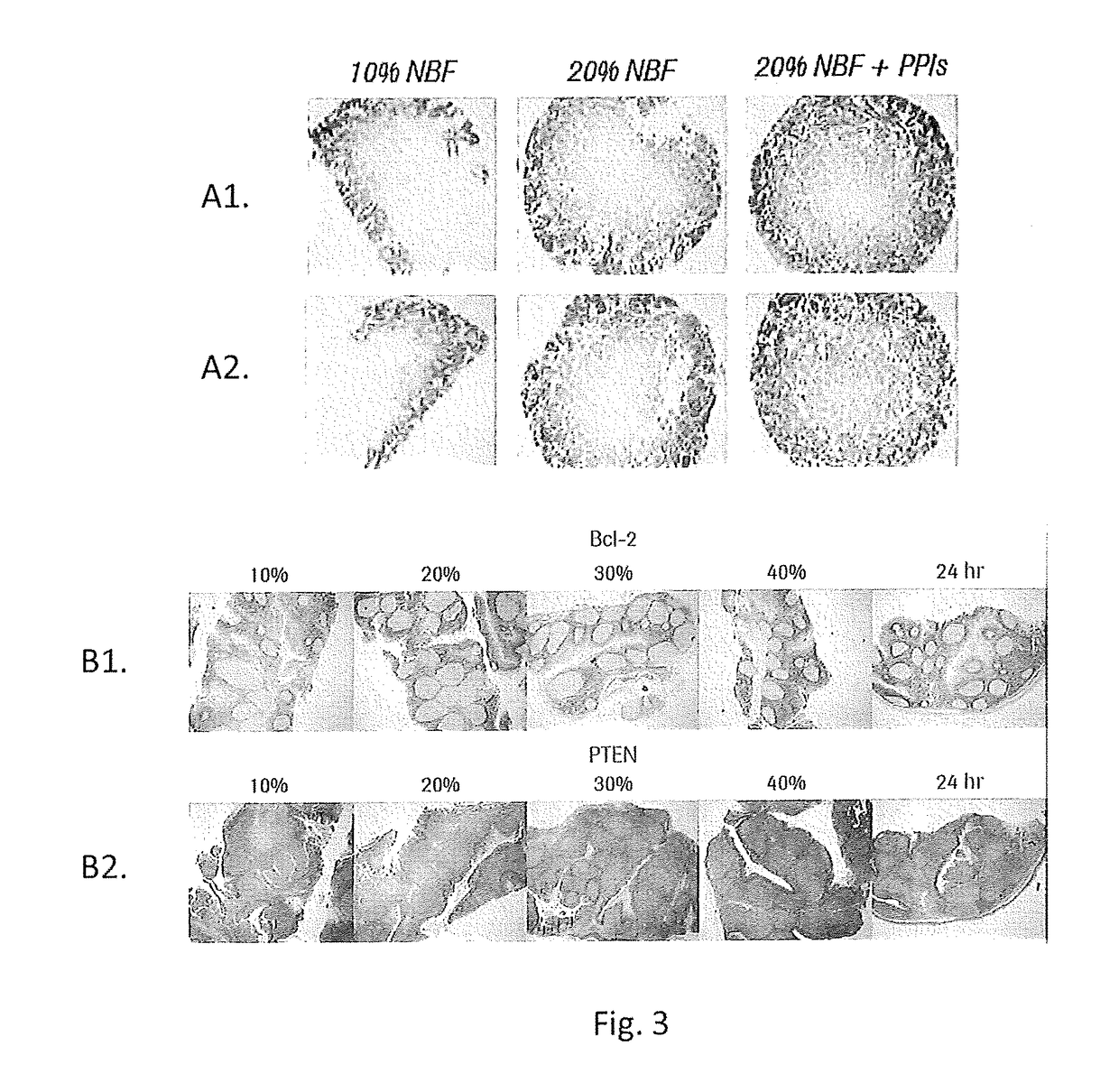 Compositions, methods, and systems for tissue fixation