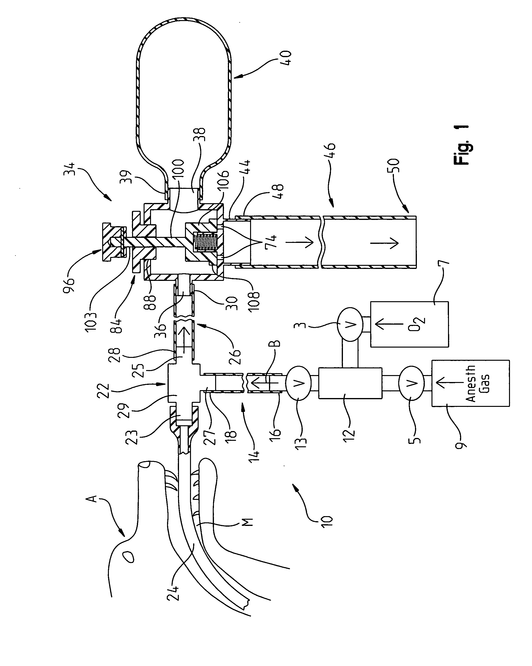 Ventilation valve for a veterinary anesthesia system