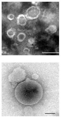 Application and detection method of protein TNFAIP8 in plasma small extracellular vesicles