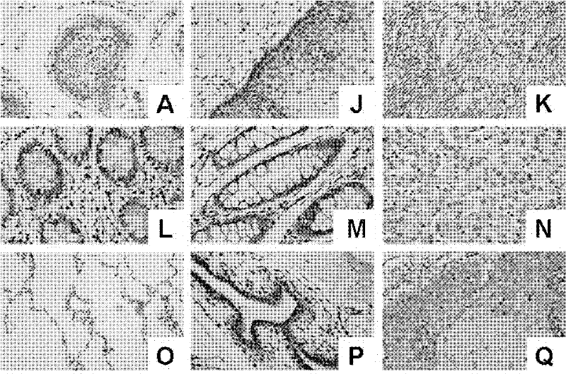 Method for screening and identifying tumor/testis antigens based on monoclonal antibodies with spermatogenic cell specificities