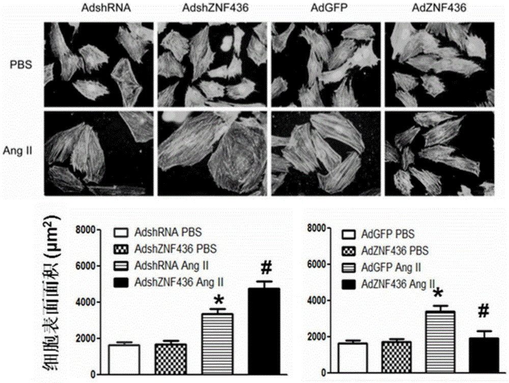 Application of zinc finger protein 436 (ZNF 436) to treatment of myocardial hypertrophy