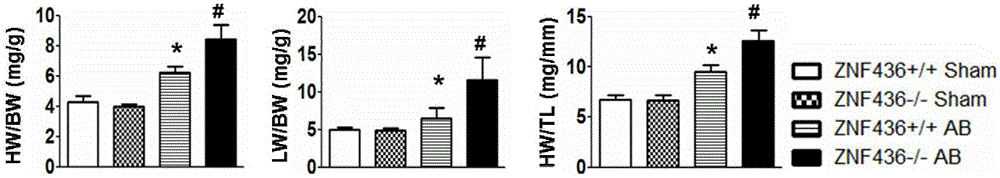 Application of zinc finger protein 436 (ZNF 436) to treatment of myocardial hypertrophy