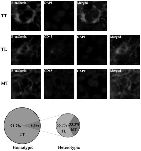 Application of melatonin in preparation of medicine for treating and adjunctively treating osteosarcoma