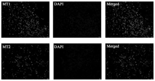 Application of melatonin in preparation of medicine for treating and adjunctively treating osteosarcoma