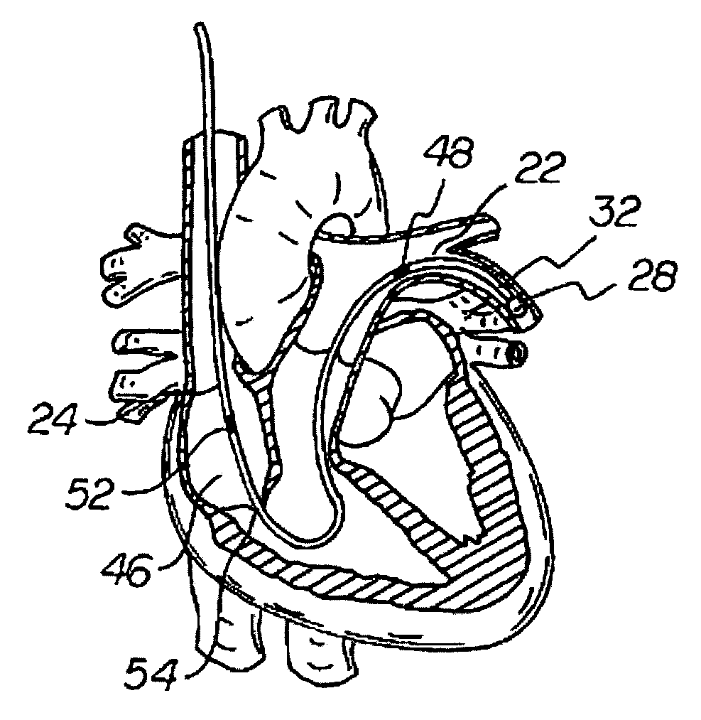 Apparatus and method for measuring myocardial oxygen consumption