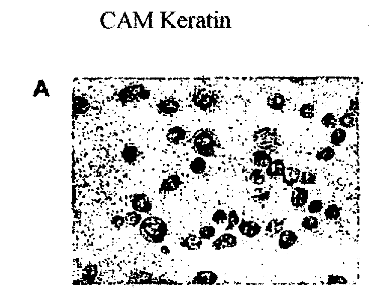 Antigen of the Pm-2 Antibody and Use Thereof