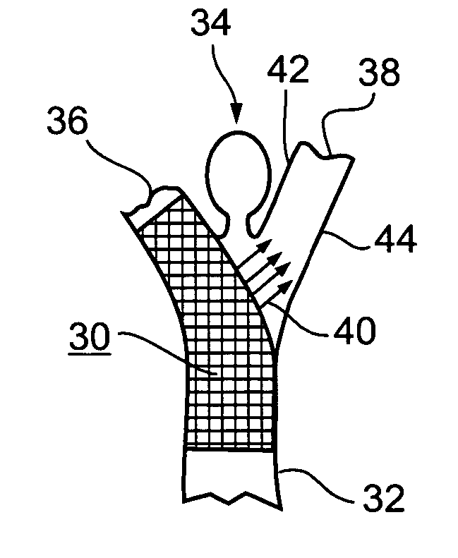 Implantable intraluminal device and method of using same in treating aneurysms