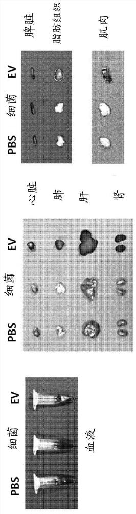 Nanovesicles derived from bacteria of genus deinococcus, and use thereof