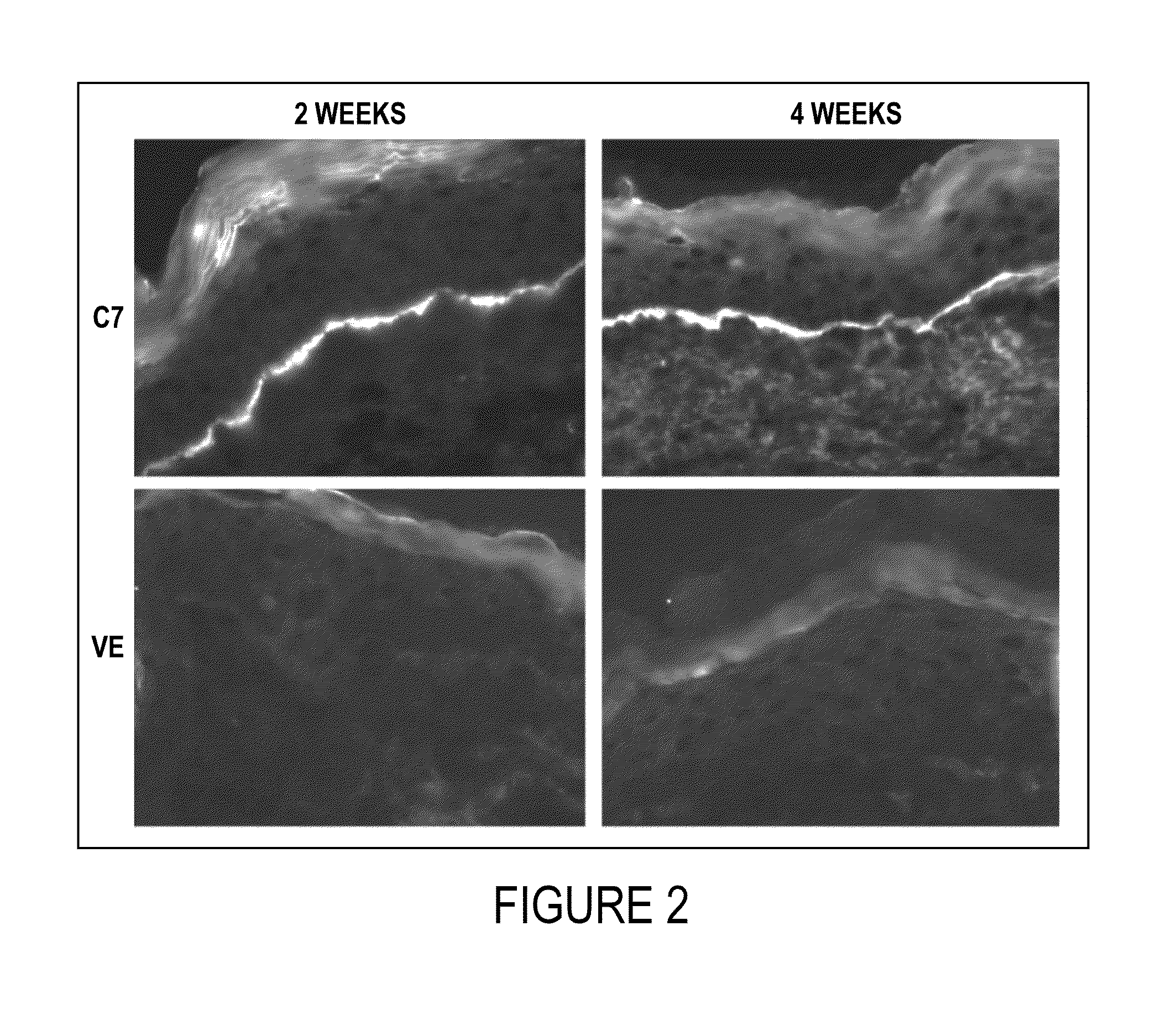 Methods and Agents for Wound Healing