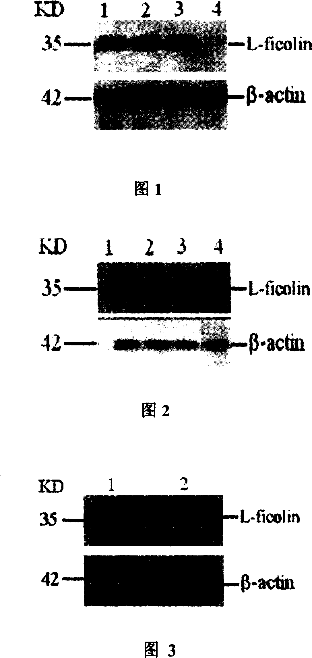 Expression carrier for human L-type complement agglutinant fibre gelled protein and construction and application