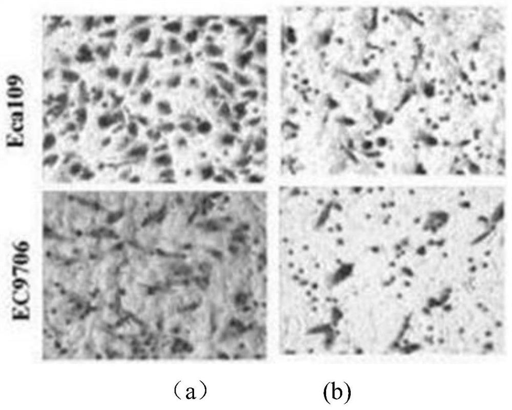 Medicine for treating carbon ion radiotherapy-chemotherapy syndromes of esophageal cancer and preparation method thereof