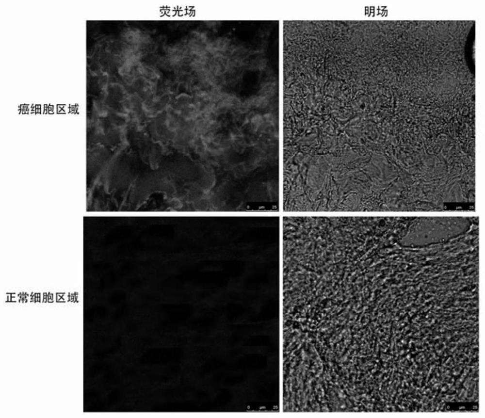 Application of lightening type fluorescent compound in preparation of liver cancer diagnosis kit and dyeing method