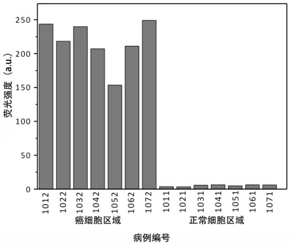 Application of lightening type fluorescent compound in preparation of liver cancer diagnosis kit and dyeing method