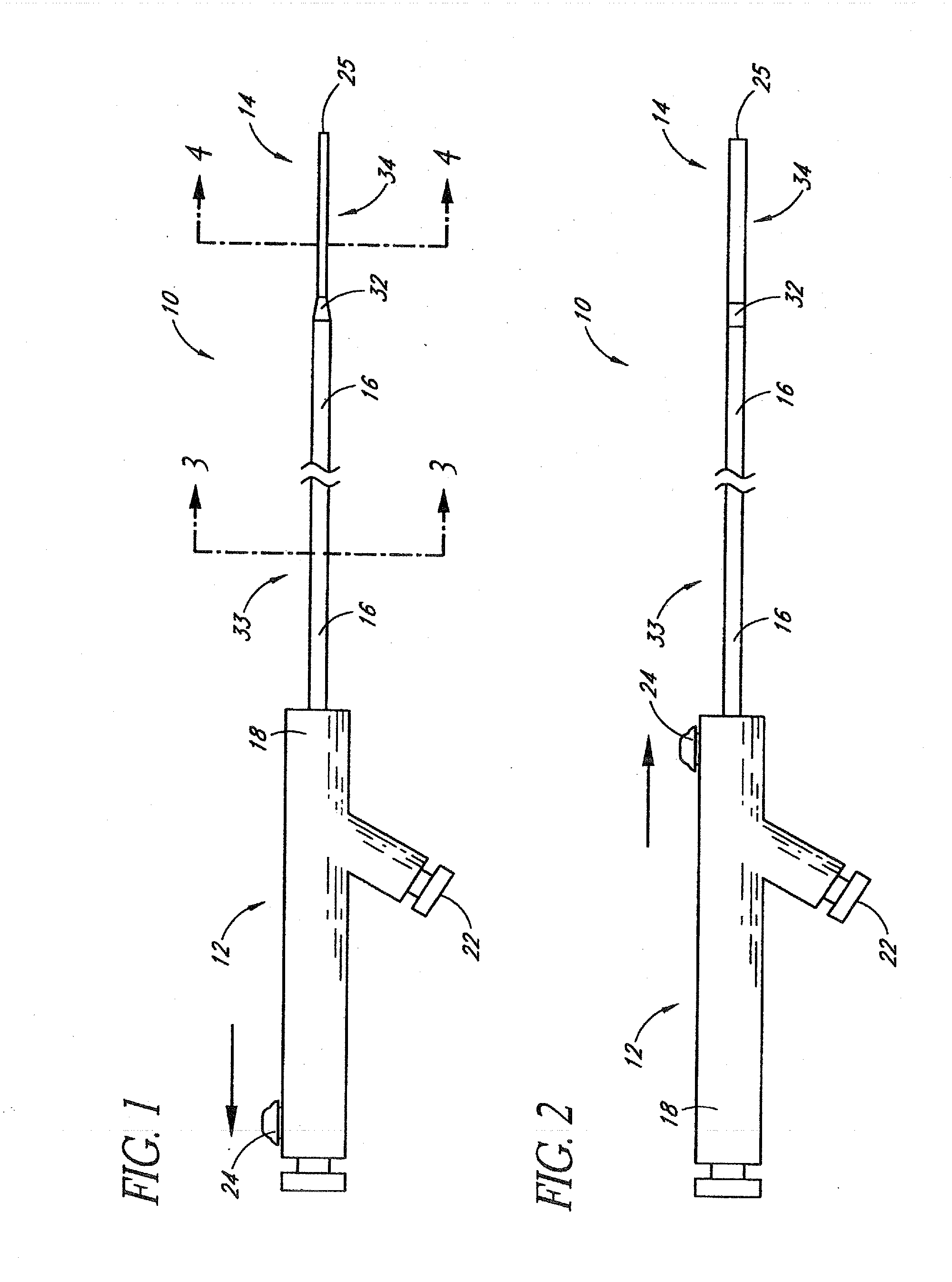 Systems and methods for removing obstructive matter from body lumens and treating vascular defects