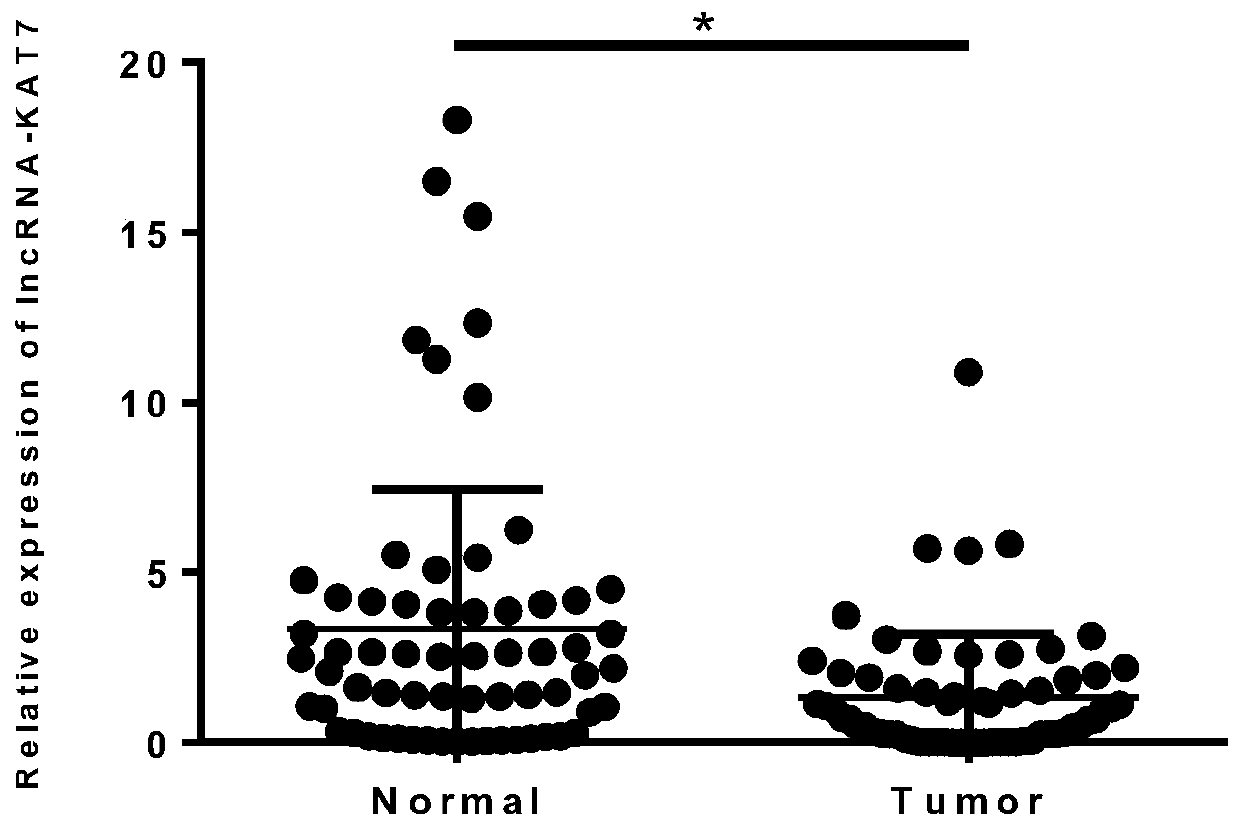 A tumor marker related to colorectal cancer and its application