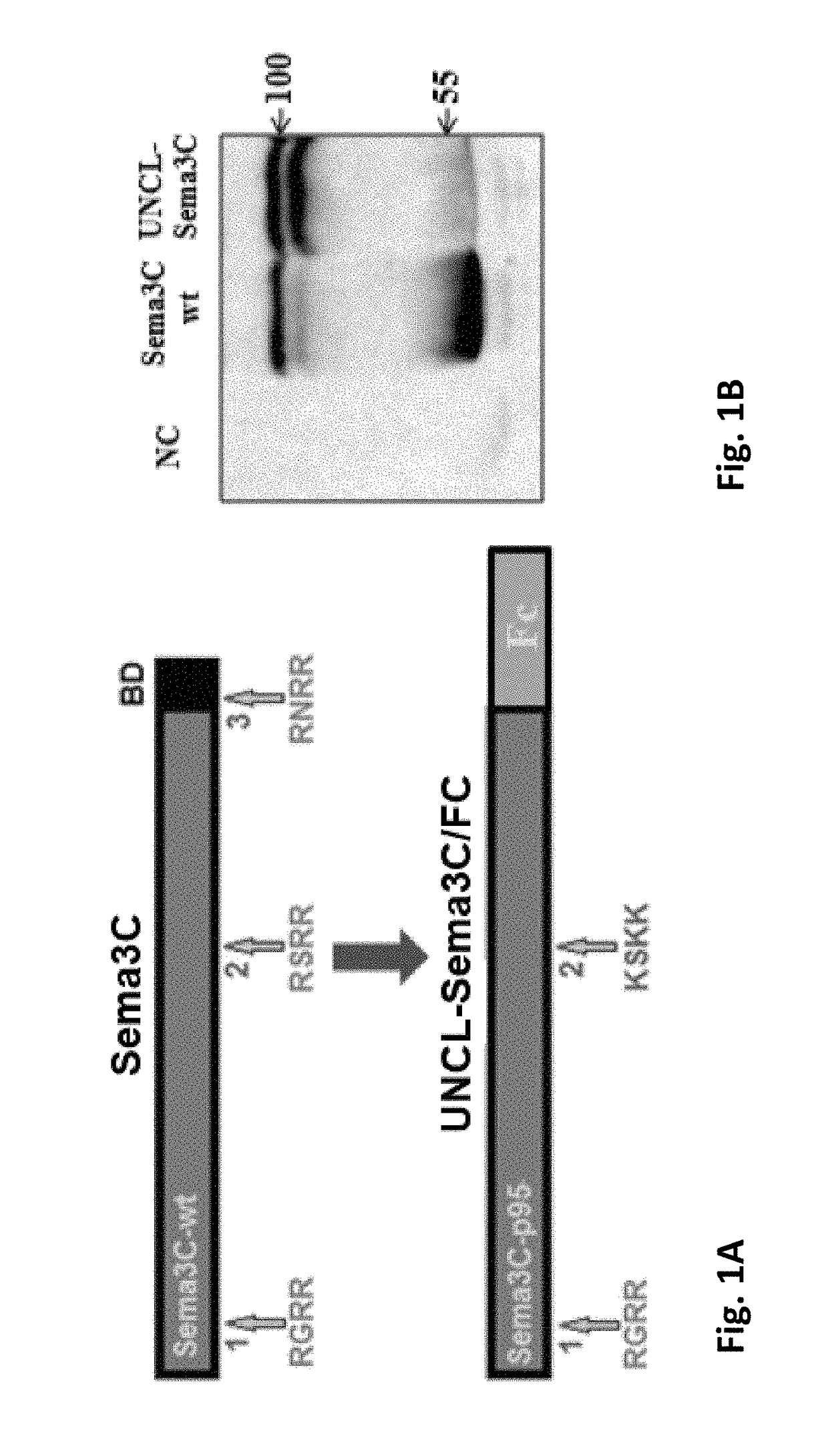 Semaphorin 3c variants, compositions comprising said variants and methods of use thereof in treating eye diseases