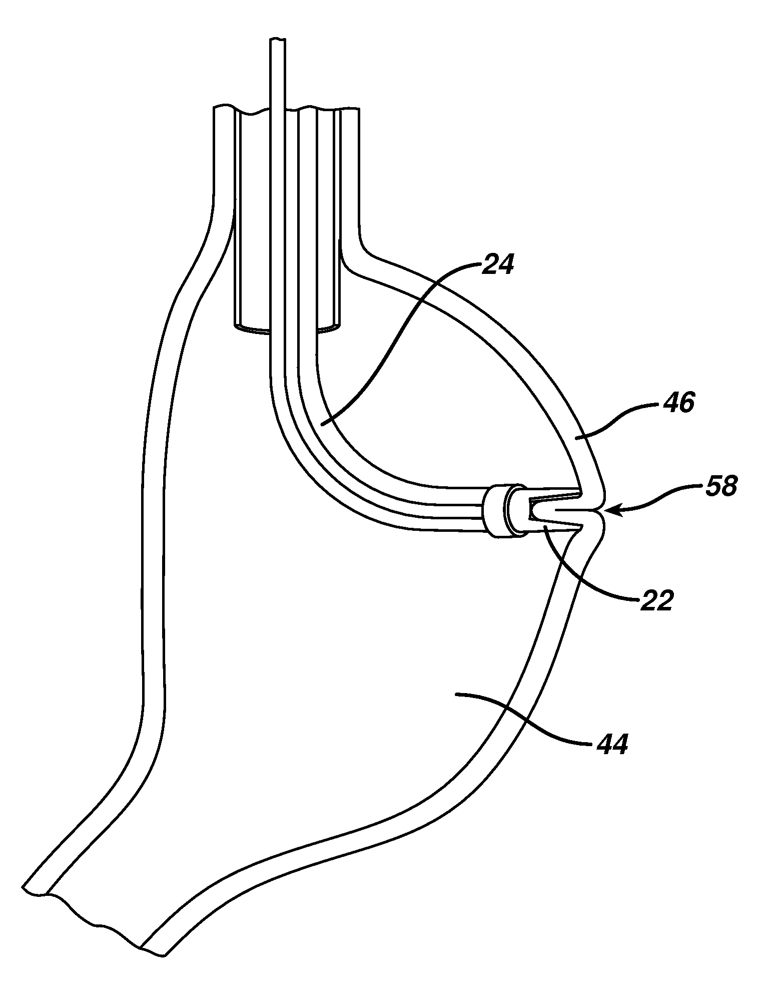 Method for plicating and fastening gastric tissue