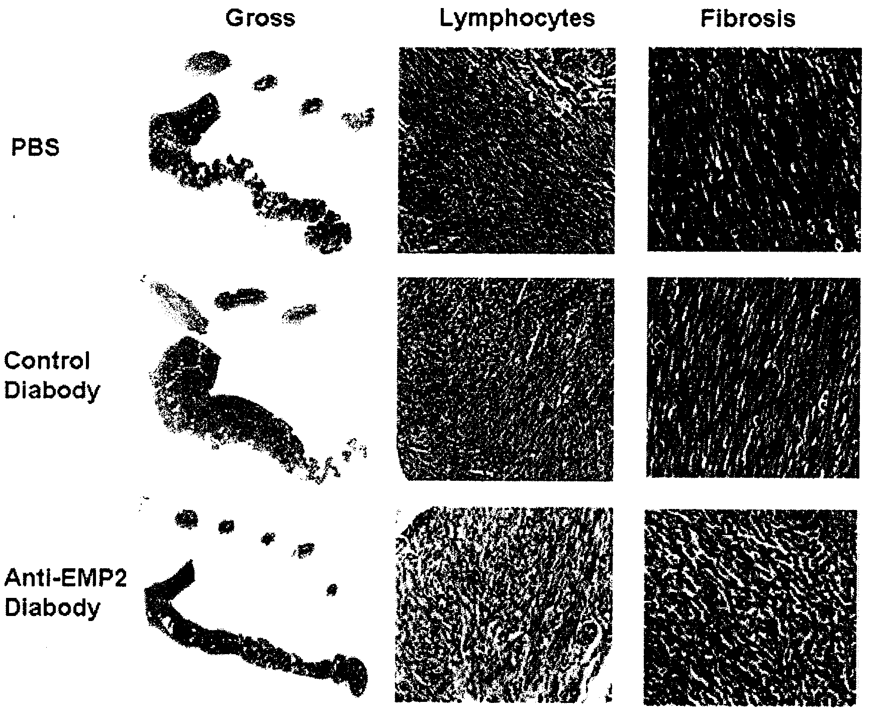 Prevention of chlamydia infection using a protective antibody