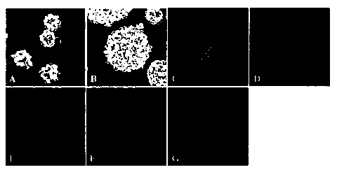 Method of inducing differentiation of neural stem cell into dopaminergic neuron by using recombinant slow virus