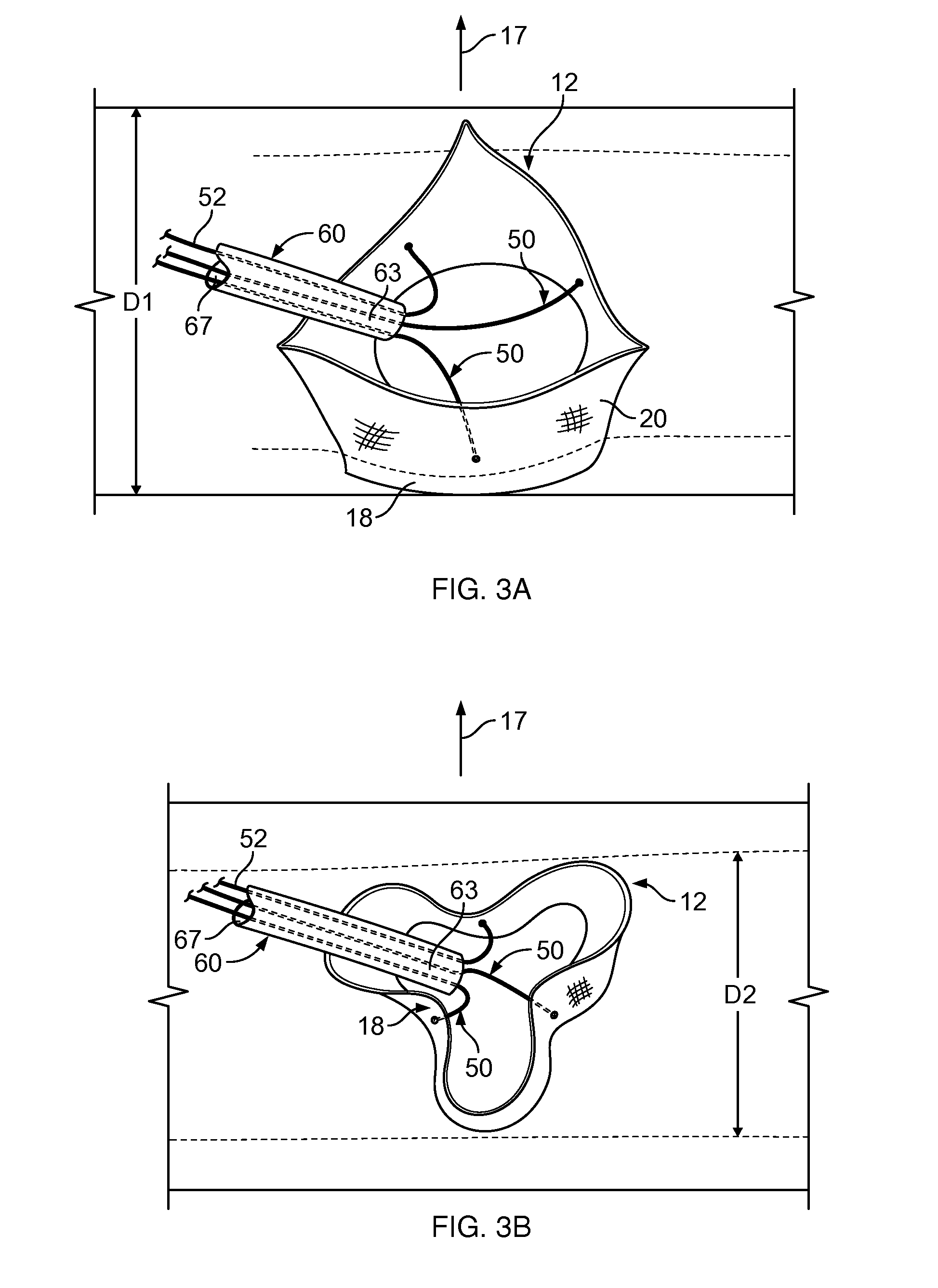 Multiple component prosthetic heart valve assemblies and apparatus for delivering them