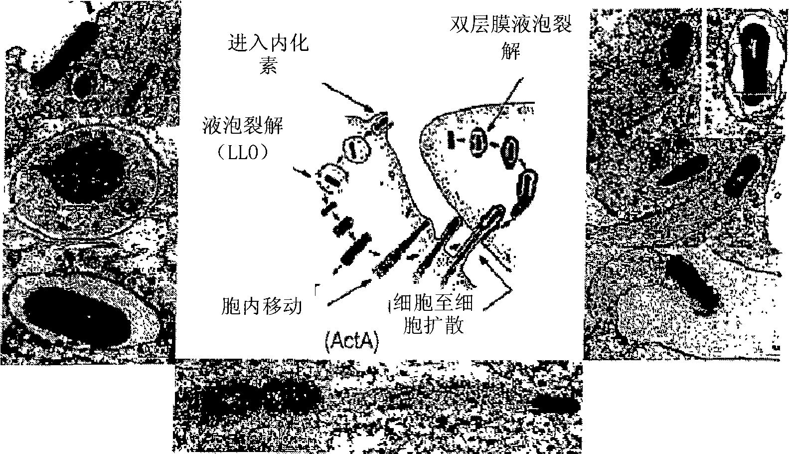 Listeria-based EphA2 vaccines