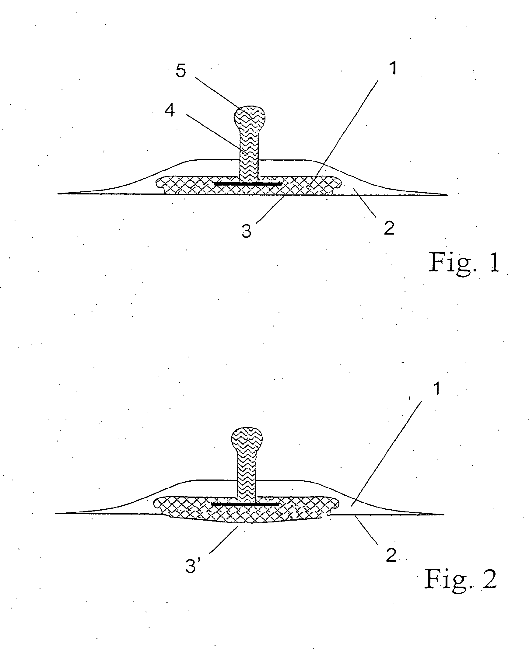 Electrode belt for carrying out electrodiagnostic procedures on the human body