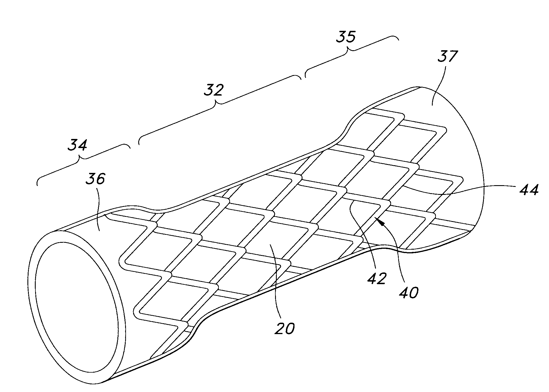 Stent with Anti-migration feature
