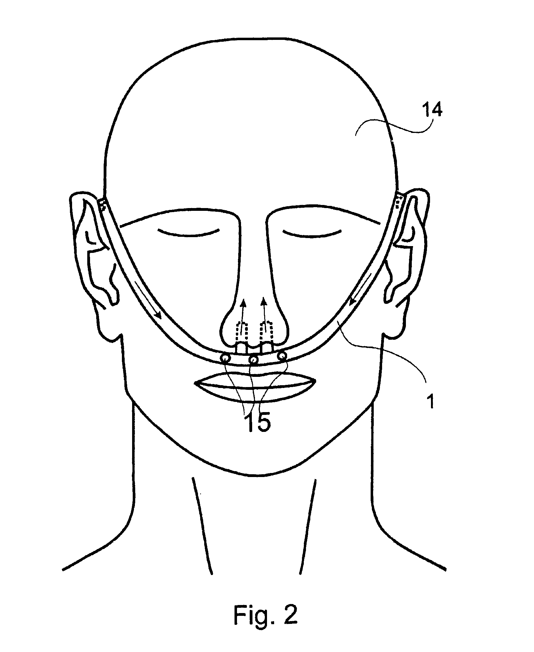Anti-snoring device, method for reducing snoring, and a nasal air cannula