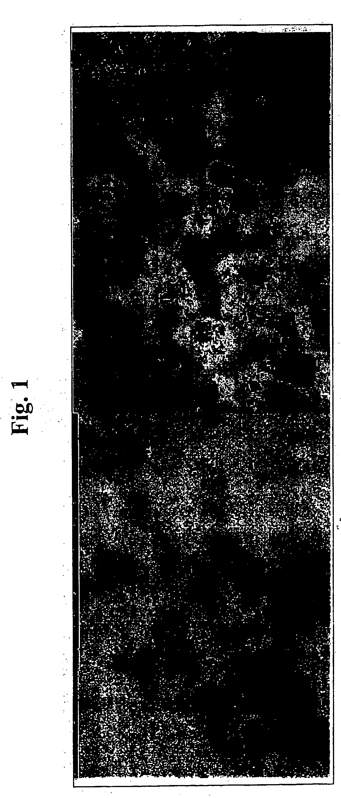 Method for detection of micro-metastasis